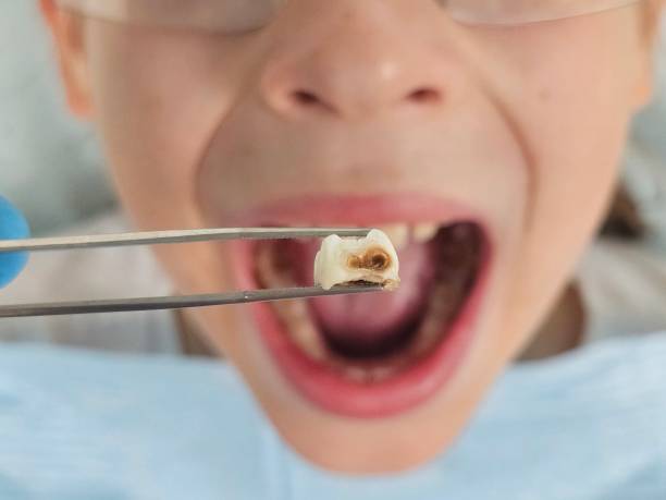 Best Root Canal Emergency Dentist  in East End, AR